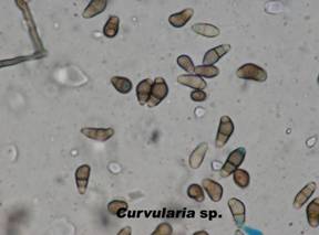 1 curvularia sp