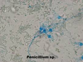 7 penicilliumsp