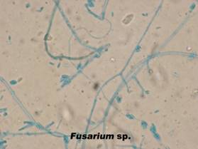20 fusarium sp