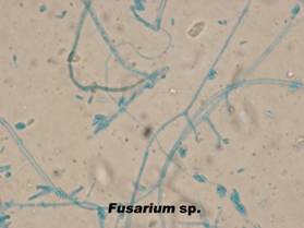 20 fusarium sp